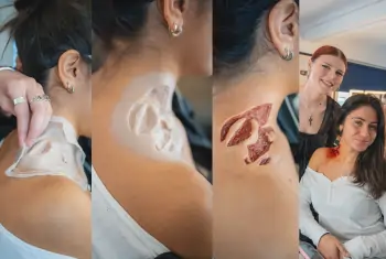 Applying Prosthetics